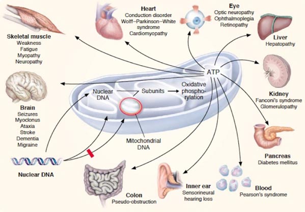 mitochondrial disease